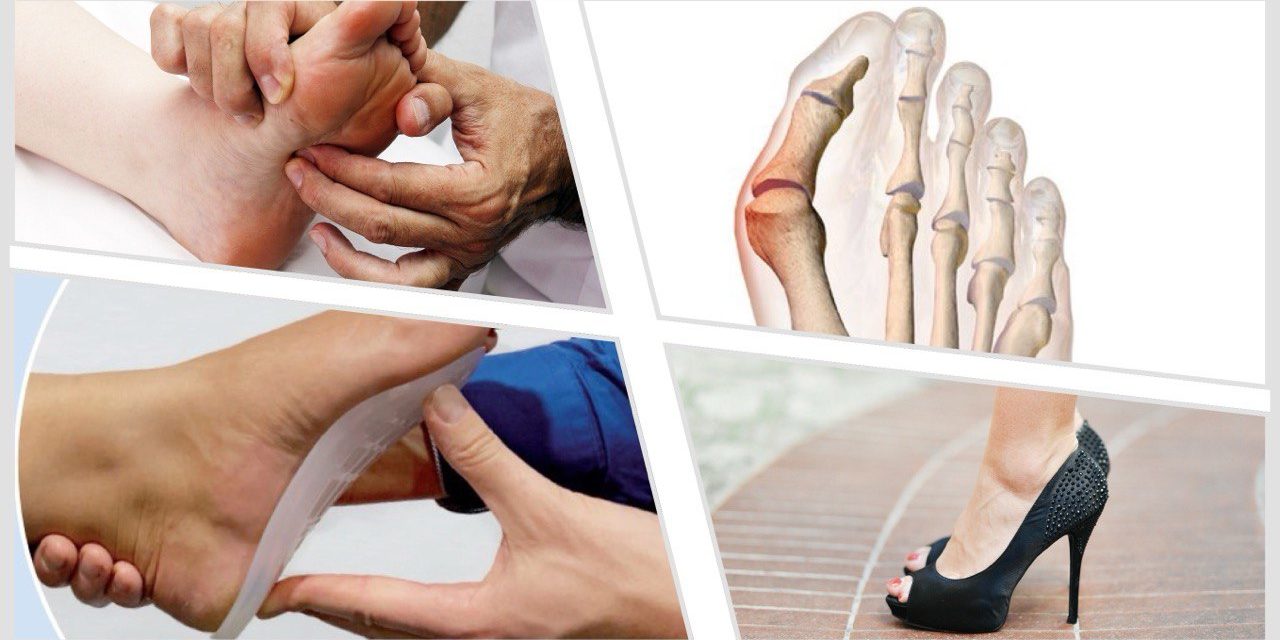 Stepflex-Collage4 IMB Fuß-Paket mit StepFlex Sohlen